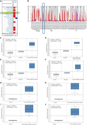 Exploring the Differential Expression and Prognostic Significance of the COL11A1 Gene in Human Colorectal Carcinoma: An Integrated Bioinformatics Approach